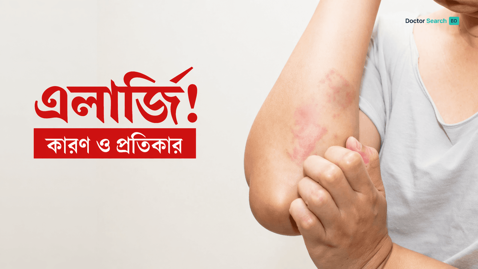 এলার্জির লক্ষণ ও প্রতিকার: বর্তমান সময়ে কেন বাড়ছে এবং কীভাবে নিয়ন্ত্রণ করবেন