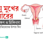 জরায়ু মুখের ক্যান্সারের কারণ, লক্ষণ ও চিকিৎসা: একটি পূর্ণাঙ্গ গাইডলাইন