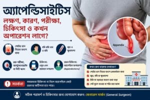 অ্যাপেন্ডিসাইটিস: লক্ষণ, কারণ, পরীক্ষা, চিকিৎসা ও কখন অপারেশন লাগে?